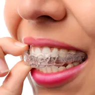 New York City Dentists Invisalign Orthodontics